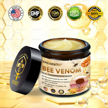 𝑨𝑷𝑲𝑨𝑷𝑲™🍯𝑩𝒆𝒆 𝑽𝒆𝒏𝒐𝒎 𝑺𝒌𝒊𝒏 𝑻𝒓𝒆𝒂𝒕𝒎𝒆𝒏𝒕 𝑪𝒓𝒆𝒂𝒎 (AAD Recommended)🍯